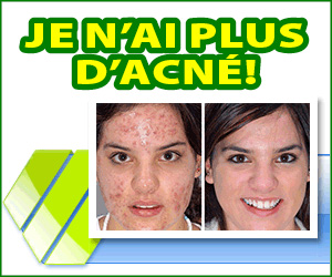 Derminax - acné